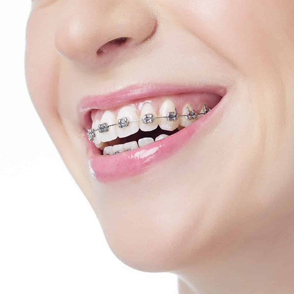 @@