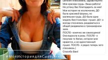 История пациента I Маммопластика I Пластический хирург Сиверина Е.А.