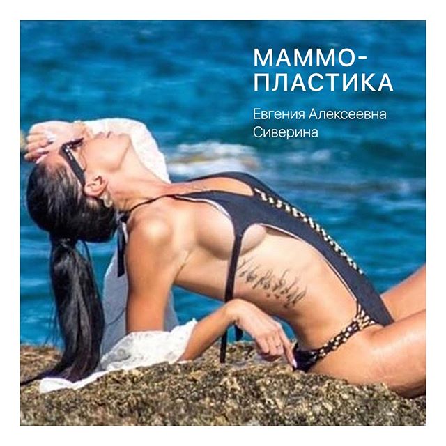 Маммопластика: Сиверина Евгения Алексеевна